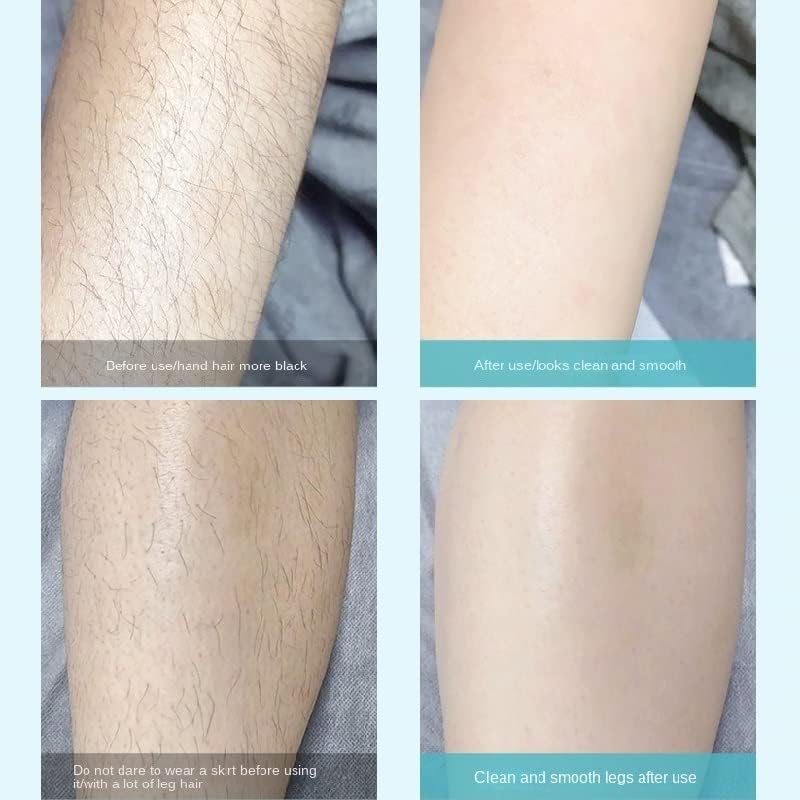 Imported™ Flawless Painless Women’s Razors – Bikini & Body Hair Removal, Safe for Sensitive Areas [Buy 1 Get 1 Free] 🎁