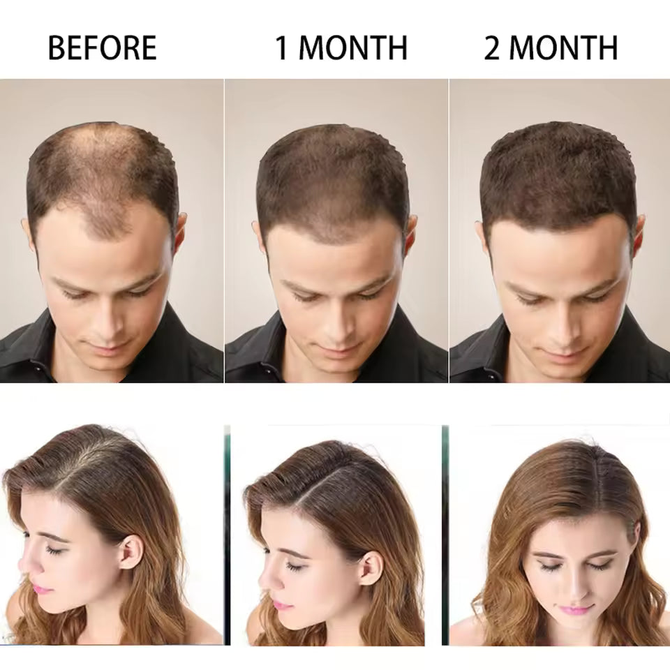 Imported™ Disaar Hair Shampoo Anti Hair Loss + Free Hair Essental Oil 🎁
